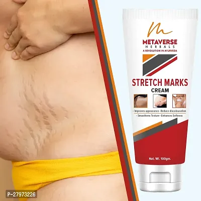 Stretch Mark cream for pregnancy | Stretch Mark lotion | Stretch mark therapy cream | Stretch Mark Creams | Stretch Mark Removal Cream-thumb0