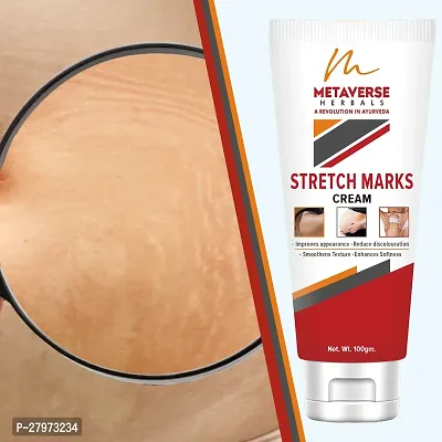 Postpartum Stretch Mark Cream | Stretch Mark Prevention Oil | Stretch Mark Cream for Men | Anti-Stretch Mark Body Butter | Stretch Mark Treatment |-thumb0