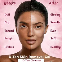 Ooplore Tan Removal Face Pack  Cleansing Dead Skin ,  D Tan Removal 100ML (Pack Of 2)-thumb1