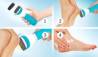 Starzz PRESENTS PEDICURE ROLLER WITH USB OPERATED BEST FOR DEAD SKIN AND PEDICURE AND MANICURE TREATMENT-thumb3