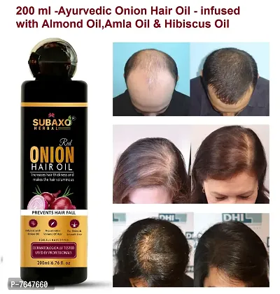 Subaxo Herbal Ayurvedic Red Onion Hair Oil / /Infused with Blackseed oil //Anti Hair Fall // For Long -Healthy Hair// -200 ML