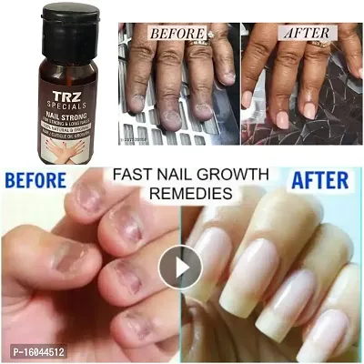 Nail Growth  Serum Oil For Long,Strong,Nail Break Treatment,Nail Break From Middle,Strong Nail,Nail Treatment