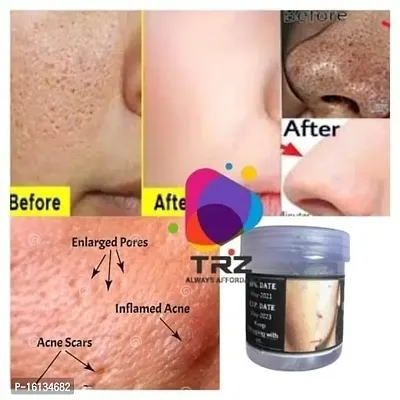 Open Pore Control Solution 100% Herbal Ayurvedic Face Cream