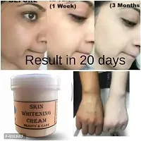 Skin Whitening Fairness Blackness Removing Face Whitening Cream 70gm Pack Of 1-thumb1