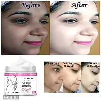 Skin Whitening Cream For Whitens Skin, Remove Melanin and Visible Fair Skin-thumb2