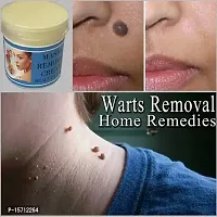 Mole Wart Remover Cream, Massa Removal Cream-thumb1