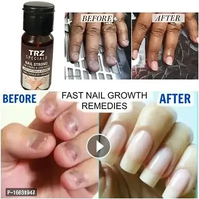 Premium Nail Growth Oil For Long,Strong,Pink Nail Help To Protect Break Nail-thumb0