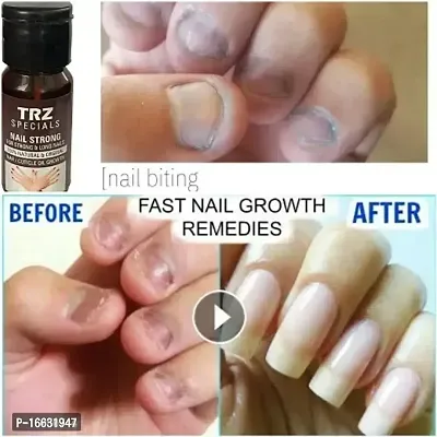 Premium Nail Growth Oil For Long,Strong,Pink Nail Help To Protect Break Nail-thumb5