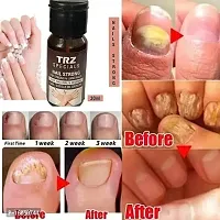 Premium Nail Growth Oil For Long,Strong,Pink Nail Help To Protect Break Nail-thumb1