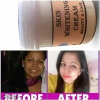 TRZ   Skin Whitening Cream Look as young as U feel -Acne Care Face Cream, Face Cream For Oily Skin, Anti Pimple Cream, Face Cream For Women, Face Cream For Men and women-thumb2