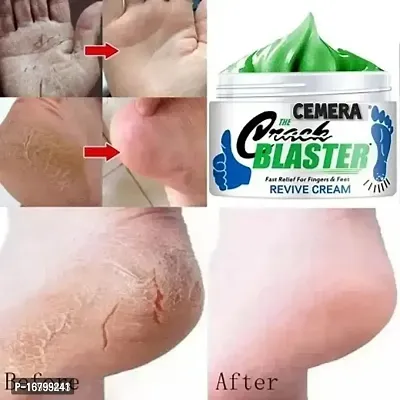 Foot Care Cream for Rough  cracked Heel repair Dry  Dehydrated-thumb0