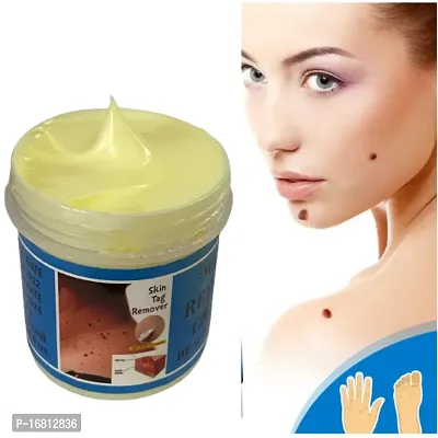 Wart, massa,mole Skin Tag Removing Cream-thumb2