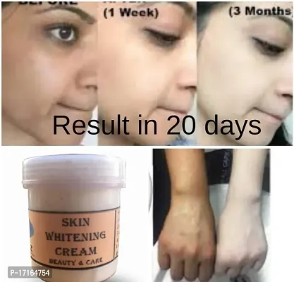 Skin Whitening And Brightening Cream, Face Cream For  Underarm-Elbow-Neck-Private Part