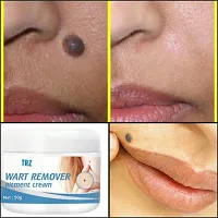 Warts Remover Ointment Wart Treatment Cream For Scar Removal, Anti-acne  Pimples, Marks  Spots Removal-thumb1