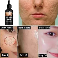 Open pore serum for Niacinamide Serum For Face with Zinc for Acne, Acne Marks  Blemishes | Oil Balancing Serum For Oily Acne Prone Skin-thumb1