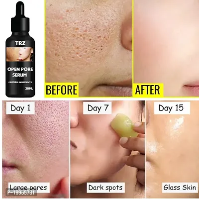 Open pore serum for Niacinamide Serum For Face with Zinc for Acne, Acne Marks  Blemishes | Oil Balancing Serum For Oily Acne Prone Skin-thumb4