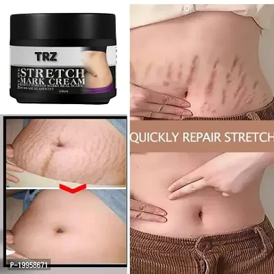 Stretch Mark Removing Cream For Scar Removal | Uneven Skin Tone| Stretch Marks  Ageing Signs for Glowing Skin | All Skin Types-thumb0