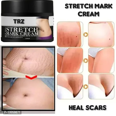 Stretch Mark Removing Cream For Scar Removal | Uneven Skin Tone| Stretch Marks  Ageing Signs for Glowing Skin | All Skin Types-thumb4