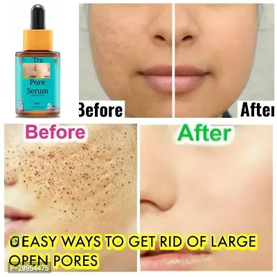 Open Pore minimzing Face serum
