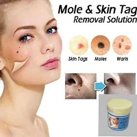 Herbal Wart Removal  Skin Tag ,Massa ,Moles Remover Massa Nashak Cream-thumb2