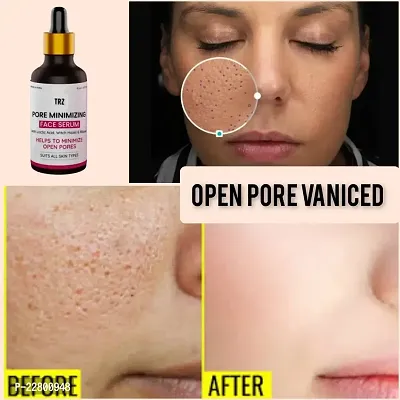 Bye Bye Open Pore Serum For Pore Tightening And Pore Minimizing 30ml