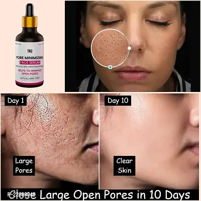 Bye Bye Open Pore Serum For Pore Tightening And Pore Minimizing 30ml-thumb3