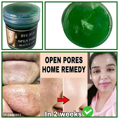 Bye Bye Open Pores Face Cream For Pore Tightening  REMOVE Acne, Blackheads, face Anti Ageing AND Whitening Serum Gel Based Cream 50g face gel-thumb0