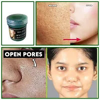Bye Bye Open Pores Face Cream For Pore Tightening  REMOVE Acne, Blackheads, face Anti Ageing AND Whitening Serum Gel Based Cream 50g face gel-thumb1