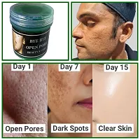 Bye Bye Open Pores Face Cream For Pore Tightening  REMOVE Acne, Blackheads, face Anti Ageing AND Whitening Serum Gel Based Cream 50g face gel-thumb2