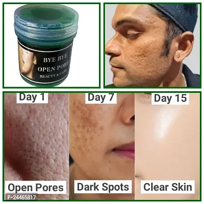 Bye Bye Open Pores Face Cream For Pore Tightening  REMOVE Acne, Blackheads, face Anti Ageing AND Whitening Serum Gel Based Cream 50g face gel-thumb3