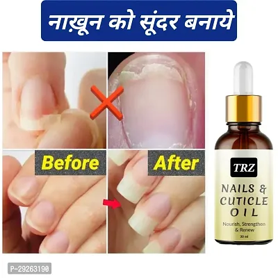 Natural Nail Serum for Damaged, Cuticle Care, Nail Growth  Strength