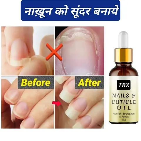 Natural Nail Serum for Damaged, Cuticle Care, Nail Growth  Strength