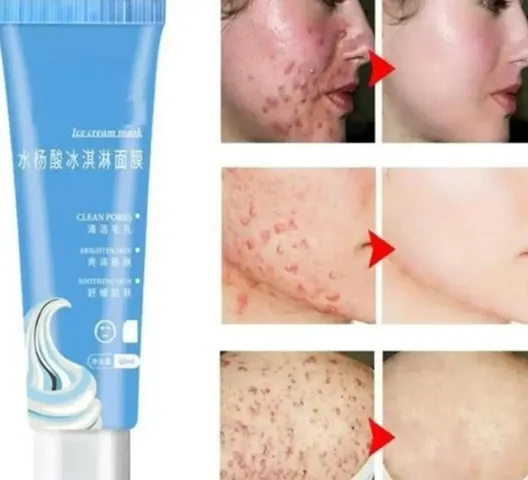 Anti Scar Skin Care Cream For Clear Skin