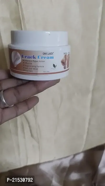 crack cream for foot