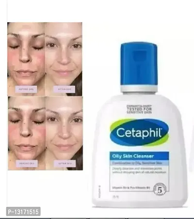 Cetaphil Oily Skin cleanser For Oily And Normal Skin Type 125ml