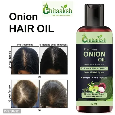 Hair Oil Onion Black Seed Hair Oil For Fast Hair Growth 50 ML Pack Of 1 For Man And Woman.-thumb0