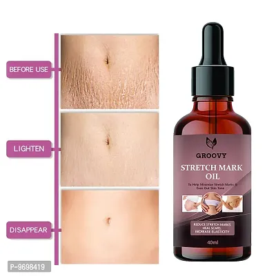 Stretch Marks Oil  Sparsh Natural Stretch Oil,  14 Herbal Oils-Kachur,  Jiwanti,  Peepal And Nariyala  40Ml Ml)-thumb0