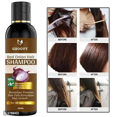 &nbsp;Onion Shampoo For Hair Regrowth Hair Shampoo And Red Onion  100 ML