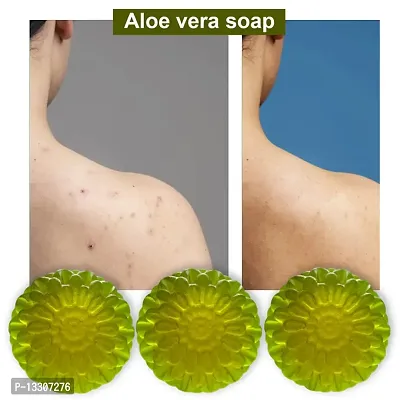 Handmade Aloe Vera Soap For Glow-100 Grams Each, Pack Of 3-thumb0