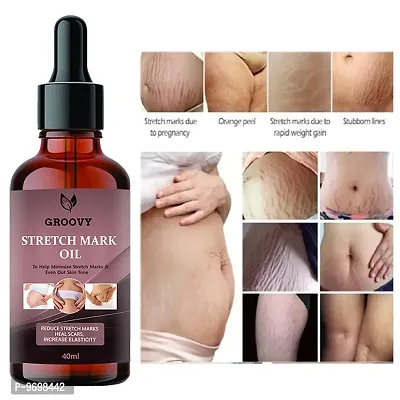 Stretch Marks Oil  Body Stretch Mark Removal Oil | Anti Aging | Pregnancy Stretch Mark Removal Oil| Scar Removal | Anti Wrinkle | Skin Hydration -40Ml-thumb0