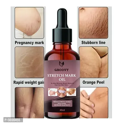 Stretch Marks Oilpregnancy And Maternity Stretch Marks Removal Cream Stretch Marks  Oils 40Ml-thumb0