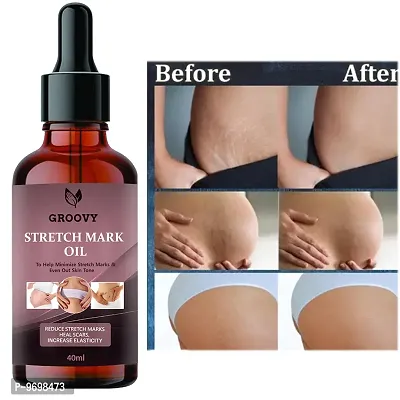 Stretch Marks Oil Ayurvedic Body Massage Bio Oil For Stretch Marks,  Oil For Scar Removal,  Aging and Wrinkled Skin  40 Ml)-thumb0