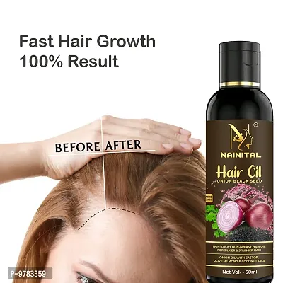 Onion Hair Oil With 14 Essential Oils For Hair Regrowth, Dandruff Control , Black Seed - Hair Care , For Hair Growth  Blend Of Multiple Essential Oils Hair Oil For Man And Woman 50Ml.Buy 1 Get 1 Free-thumb3