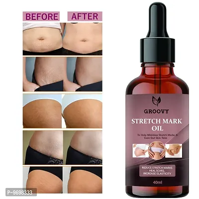 Stretch Mark Cream To Reduce Stretch Marks and Scars-40Ml  40 Ml) Pack Of 1-thumb0