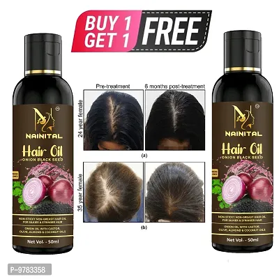 Hair Oil Onion Hair Oil For Hair Growth Hair Oil&nbsp;(50 Ml) For Man And Woman.Buy 1 Get 1 Free-thumb0