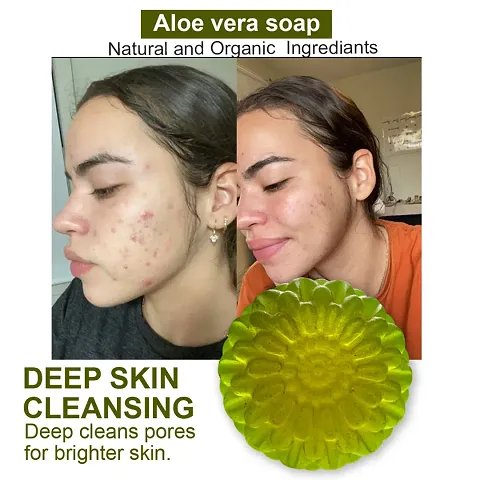 Aloe Vera Soap For Deep Cleansing -100 Grams