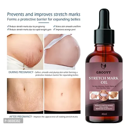 Stretch Marks Oil Stretch Mark Cream To Reduce Stretch Marks and Scars-40Ml  40 Ml) Pack Of 1-thumb0