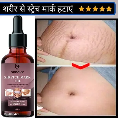 Stretch Marks Oil  Anti Stretch Mark Removal Oil Women and Men, Marks and Spots Removal (Pack Of 1)  40 Ml)-thumb0