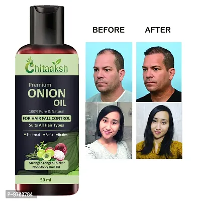 Hair Oil  Black Seed Onion Oil For Damage Control, Hair Regrowth And Hair Fall Control, Men and Women Hair Oil 50 ML-thumb0