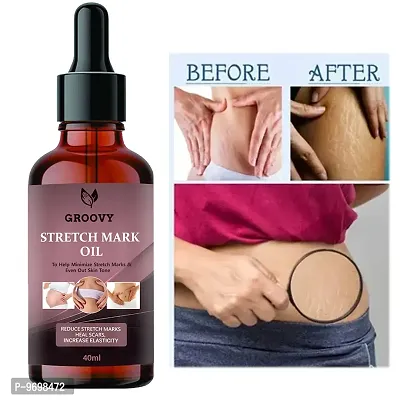 Stretch Marks Oil  Stretch Mark Oil For Moms  40 Ml)-thumb0